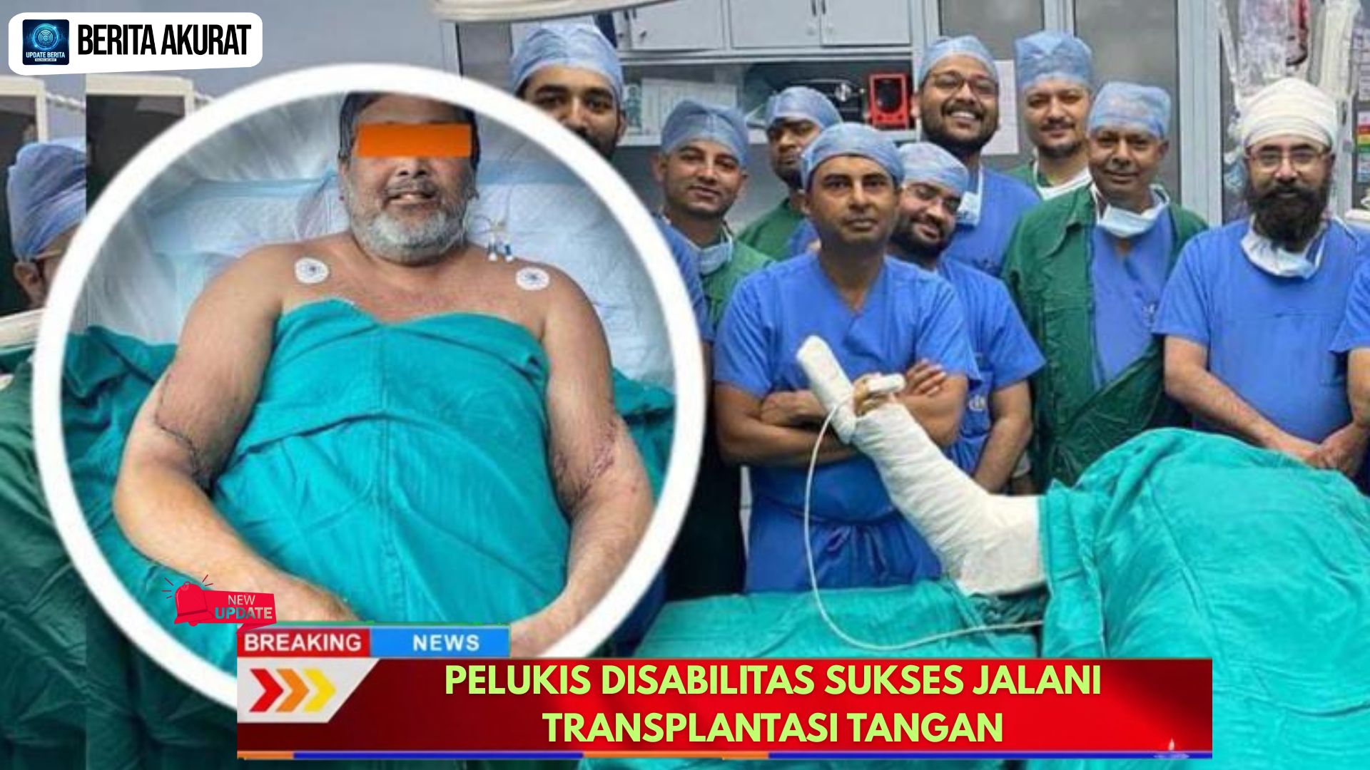 Pelukis Disabilitas Sukses Jalani Transplantasi Tangan